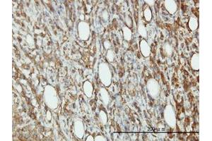 Image no. 3 for anti-Eukaryotic Translation Initiation Factor 5 (EIF5) (AA 1-432) antibody (ABIN598657) (EIF5 Antikörper  (AA 1-432))