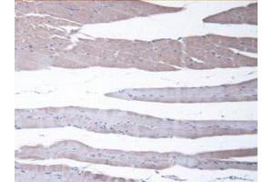 Detection of CBR1 in Mouse Skeletal Muscle Tissue using Polyclonal Antibody to Carbonyl Reductase 1 (CBR1) (CBR1 Antikörper  (AA 66-271))