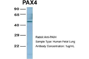 Host:  Rabbit  Target Name:  PAX4  Sample Type:  Human Fetal Lung  Antibody Dilution:  1. (PAX4 Antikörper  (Middle Region))