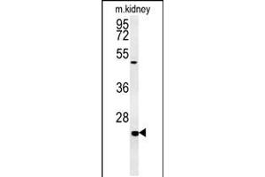 Western blot analysis in mouse kidney tissue lysates (15ug/lane). (SHISA2 Antikörper  (C-Term))