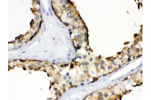 Immunohistochemistry (Paraffin-embedded Sections) (IHC (p)) image for anti-Heat Shock Protein 90kDa alpha (Cytosolic), Class A Member 1 (HSP90AA1) (AA 454-488), (C-Term) antibody (ABIN3043848)