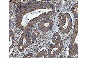 IHC analysis of TRMT61B using anti-TRMT61B antibody (ABIN7602334). (TRMT61B Antikörper  (AA 7-477))