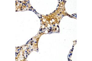 Immunohistochemistry of paraffin-embedded rat lung using MT2A antibody at dilution of 1:200 (400x lens). (MT2A Antikörper)