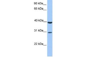 Western Blotting (WB) image for anti-JAZF Zinc Finger 1 (JAZF1) antibody (ABIN2458461) (JAZF1 Antikörper)