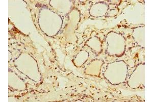 Immunohistochemistry of paraffin-embedded human thyroid tissue using ABIN7144994 at dilution of 1:100 (DDX5 Antikörper  (AA 1-210))
