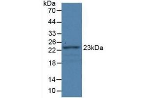 Detection of Recombinant FBLN1, Rat using Monoclonal Antibody to Fibulin 1 (FBLN1) (Fibulin 1 Antikörper)