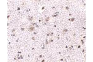 Immunohistochemistry (IHC) image for anti-Brain and Reproductive Organ-Expressed (TNFRSF1A Modulator) (BRE) (N-Term) antibody (ABIN1031282)