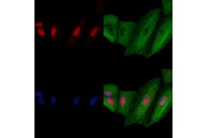 ABIN6264927 and ABIN6278743 staining  cells by IF/ICC. (SART3 Antikörper  (C-Term))