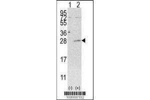 Western blot analysis of AK3 using rabbit polyclonal AK3 Antibody (C-term H38) using 293 cell lysates (2 ug/lane) either nontransfected (Lane 1) or transiently transfected with the AK3 gene (Lane 2). (Adenylate Kinase 3 Antikörper  (C-Term))