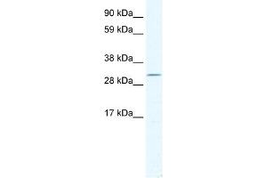 WB Suggested Anti-DMRT2 Antibody Titration:  2. (DMRT2 Antikörper  (C-Term))