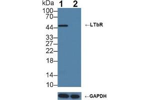 Knockout Varification: Lane 1: Wild-type U87MG cell lysate; Lane 2: LTbR knockout U87MG cell lysate; Predicted MW: 45,47kDa Observed MW: 47kDa Primary Ab: 3µg/ml Rabbit Anti-Human LTbR Antibody Second Ab: 0. (LTBR Antikörper  (AA 66-215))