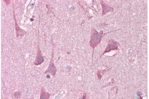 Anti-LRRTM2 antibody IHC staining of human brain, cortex. (LRRTM2 Antikörper  (C-Term))