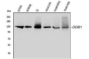 Western blot analysis of DDB1 using anti-DDB1 antibody (ABIN3043823). (DDB1 Antikörper  (AA 1011-1140))