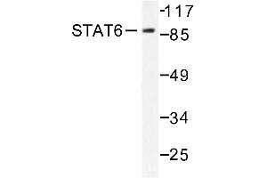 Image no. 1 for anti-Signal Transducer and Activator of Transcription 6, Interleukin-4 Induced (STAT6) antibody (ABIN271832) (STAT6 Antikörper)
