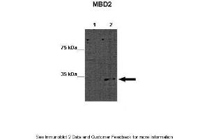 Lanes:   Lane 1: 15ug WT mouse ES lysate Lane 2: 15ug MBD2 KO mouse ES lysate  Primary Antibody Dilution:   1:1000  Secondary Antibody:   Goat anti-rabbit-HRP  Secondary Antibody Dilution:   1:2500  Gene Name:   MBD2 a  Submitted by:   Austin J. (MBD2 Antikörper  (Middle Region))