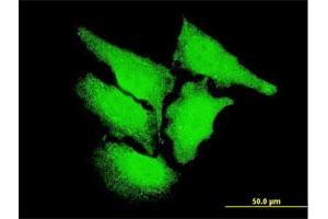 Immunofluorescence of monoclonal antibody to CAMK2D on HeLa cell. (CAMK2D Antikörper  (AA 301-410))