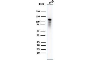 Western Blot Analysis of PC3 cell lysate using Drebrin-1 Mouse Monoclonal Antibody (DBN1/2880).
