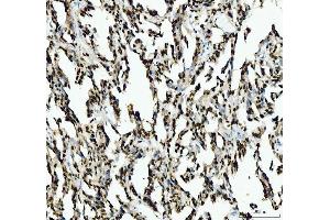 IHC analysis of SFPQ using anti-SFPQ antibody (ABIN7603089). (SFPQ Antikörper  (Middle Region))