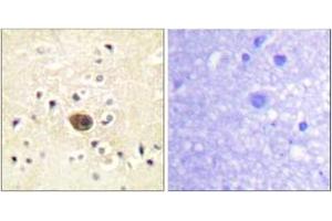 Immunohistochemistry analysis of paraffin-embedded human brain tissue, using Ras-GRF1 (Ab-916) Antibody. (RASGRF1 Antikörper  (AA 882-931))