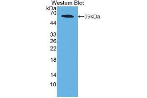 Western blot analysis of the recombinant protein. (Fibrillin 2 Antikörper  (AA 1550-1791))