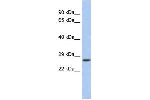 WB Suggested Anti-VENTX Antibody Titration:  0.