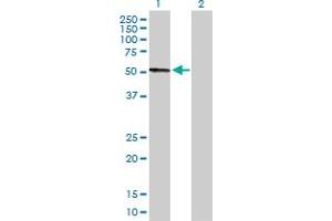 Western Blot analysis of CPB2 expression in transfected 293T cell line by CPB2 MaxPab polyclonal antibody. (CPB2 Antikörper  (AA 1-423))