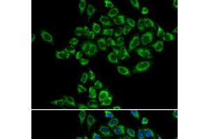 Immunofluorescence analysis of HeLa cells using SRPK1 Polyclonal Antibody