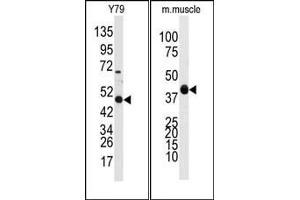Image no. 1 for anti-Aldehyde Dehydrogenase 3 Family, Member A1 (ALDH3A1) (Middle Region) antibody (ABIN360203) (ALDH3A1 Antikörper  (Middle Region))