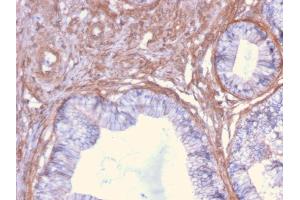 Formalin-fixed, paraffin-embedded human Cervix stained with Drebrin-1 Mouse Monoclonal Antibody (DBN1/2879).