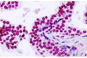 Human, Prostate: Formalin-Fixed Paraffin-Embedded (FFPE) (TARSL2 Antikörper  (AA 644-674))