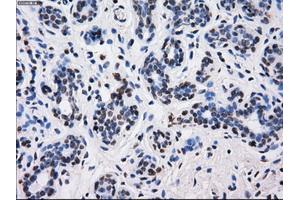 Immunohistochemical staining of paraffin-embedded breast tissue using anti-BTN3A2 mouse monoclonal antibody.