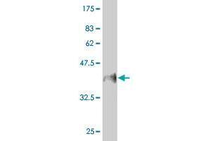Western Blot detection against Immunogen (37. (MUC5B Antikörper  (AA 4186-4295))