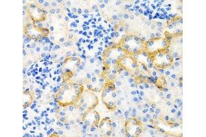 Immunohistochemistry of paraffin-embedded Rat kidney using STC1 Polyclonal Antibody at dilution of 1:100 (40x lens).