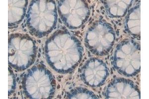 Immunohistochemistry (IHC) image for anti-Pro-Platelet Basic Protein (Chemokine (C-X-C Motif) Ligand 7) (PPBP) (AA 59-128) antibody (ABIN7431659)
