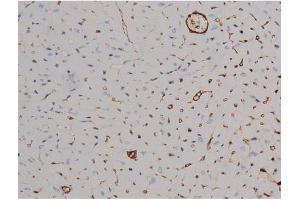 ABIN6267511 at 1/200 staining Mouse heart tissue sections by IHC-P. (STAT6 Antikörper  (pThr645))
