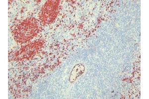 Immunohistochemistry (IHC) image for anti-Endothelial Cells antibody (ABIN781798) (Endothelial Cells Antikörper)