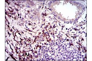 Immunohistochemistry (IHC) image for anti-Transforming Growth Factor, beta 1 (TGFB1) (AA 62-195) antibody (ABIN969570)