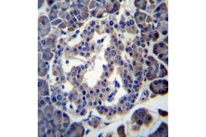 Immunohistochemistry (Paraffin-embedded Sections) (IHC (p)) image for anti-Membrane Bound O-Acyltransferase Domain Containing 4 (MBOAT4) (AA 257-287), (Middle Region) antibody (ABIN953340)