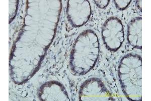 Image no. 1 for anti-Phosphoglucomutase 3 (PGM3) (AA 1-543) antibody (ABIN598868) (Phosphoglucomutase 3 Antikörper  (AA 1-543))