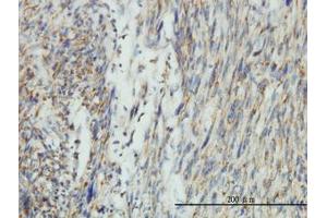 Image no. 1 for anti-Dynamin 1-Like (DNM1L) (AA 1-711) antibody (ABIN599113) (Dynamin 1-Like Antikörper  (AA 1-711))