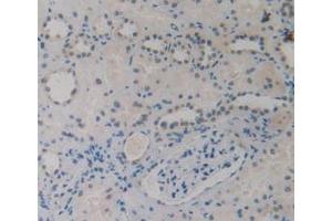 IHC-P analysis of Human Kidney Tissue, with DAB staining. (EBI3 Antikörper)