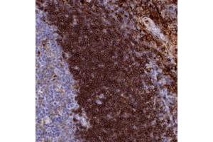 Immunohistochemical staining of human tonsil with PLAC8 polyclonal antibody  shows strong cytoplasmic positivity in lymphoid cells outside reaction centra.