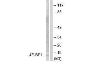 Western blot analysis of extracts from Jurkat cells, treated with Insulin (0. (eIF4EBP1 Antikörper  (Ser65))