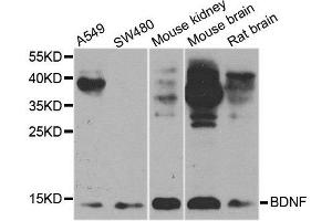 Western blot analysis of extracts of various cell lines, using BDNF antibody.