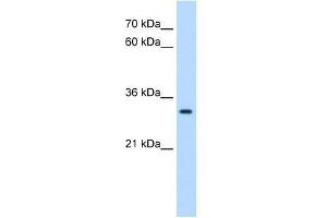 DBX2 antibody used at 0. (DBX2 Antikörper  (N-Term))