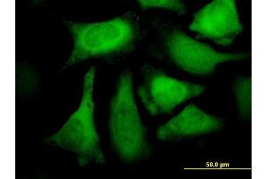 Immunofluorescence of purified MaxPab antibody to CACYBP on HeLa cell. (CACYBP Antikörper  (AA 1-228))