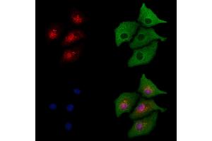 ABIN6264613 and ABIN6277733 staining  cells by IF/ICC.