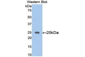 Western Blotting (WB) image for anti-Matrix Metallopeptidase 11 (Stromelysin 3) (MMP11) (AA 287-491) antibody (ABIN1078305) (MMP11 Antikörper  (AA 287-491))