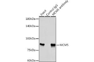 Immunoprecipitation analysis of 300 μg extracts of HeLa cells using 3 μg MCM5 antibody (ABIN6132075, ABIN6143645, ABIN6143647 and ABIN6221204). (MCM5 Antikörper  (AA 1-230))