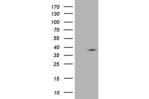Western Blotting (WB) image for anti-HSPA Binding Protein, Cytoplasmic Cochaperone 1 (HSPBP1) antibody (ABIN1498761) (HSPBP1 Antikörper)